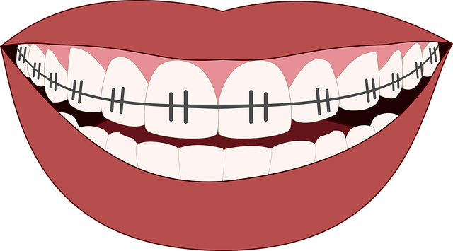 orthodontics-3109763_640